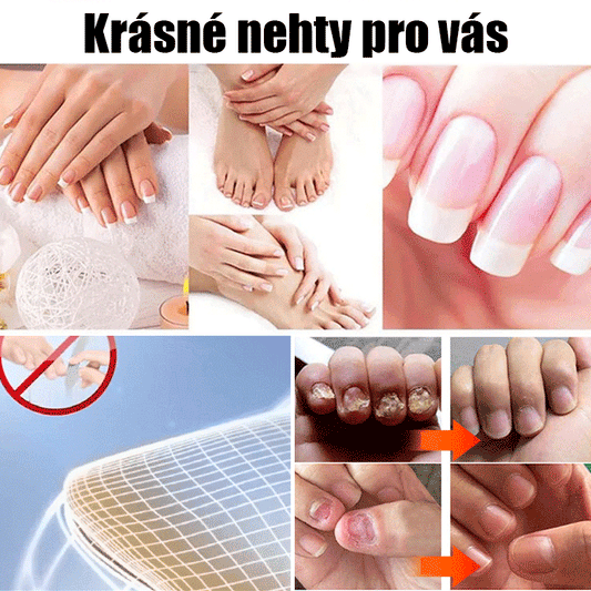 Nail treatment cream