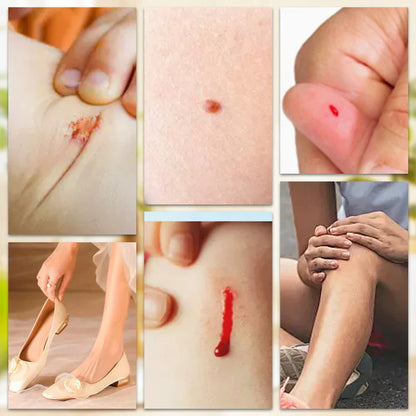 Waterproof Breathable Bandage
